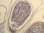 Liverwort Sporophyte Slides